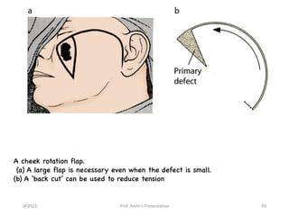 Principle of Plastic Surgery, plastic surgery notes | PDF