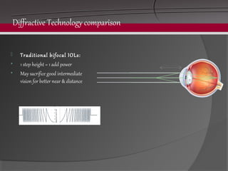 Principle of presbyopia correcting iols | PPT