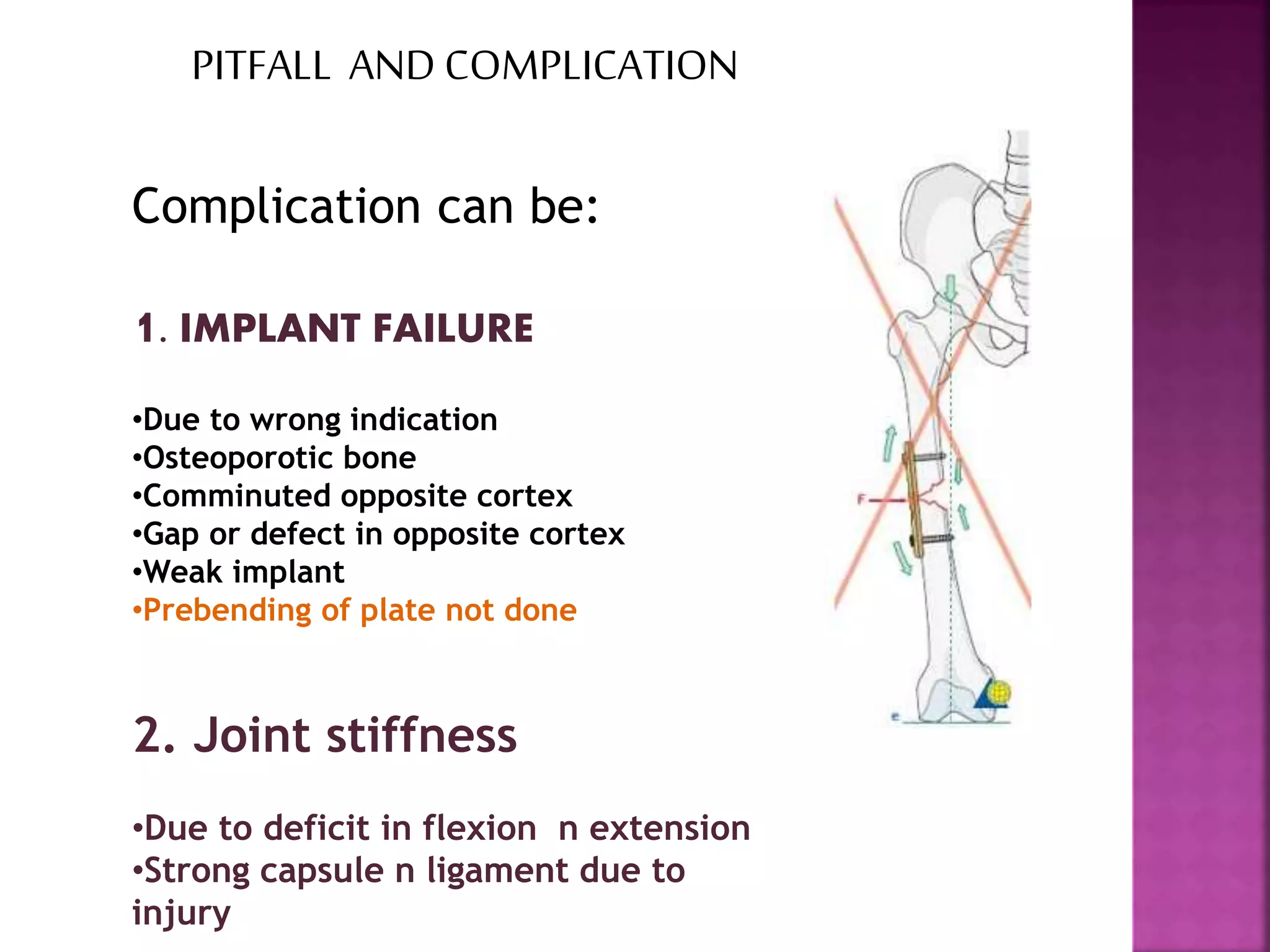 Complication can be:
1. IMPLANT FAILURE
•Due to wrong indication
•Osteoporotic bone
•Comminuted opposite cortex
•Gap or defect in opposite cortex
•Weak implant
•Prebending of plate not done
2. Joint stiffness
•Due to deficit in flexion n extension
•Strong capsule n ligament due to
injury
PITFALL AND COMPLICATION
 