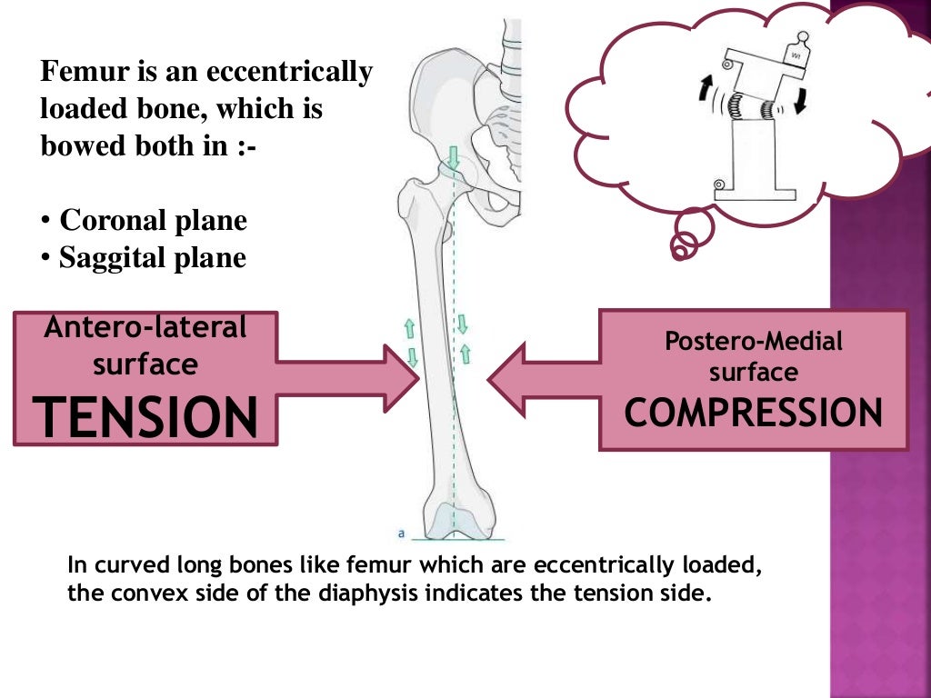 Principle of tension band wiring n its application