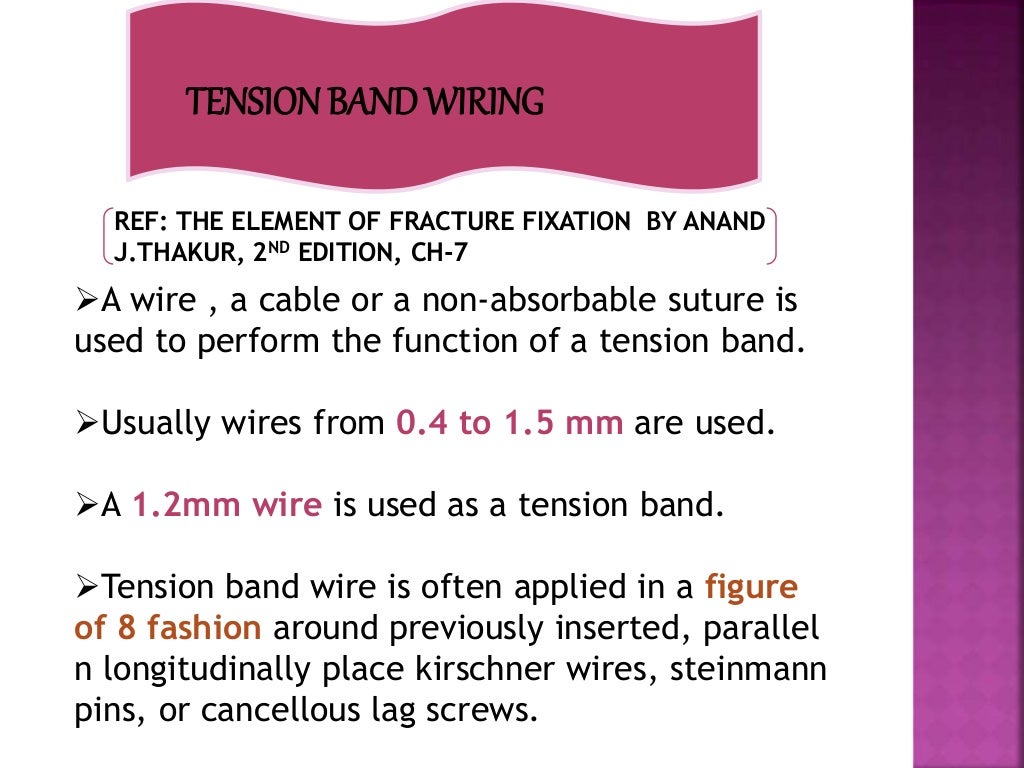 Principle of tension band wiring n its application