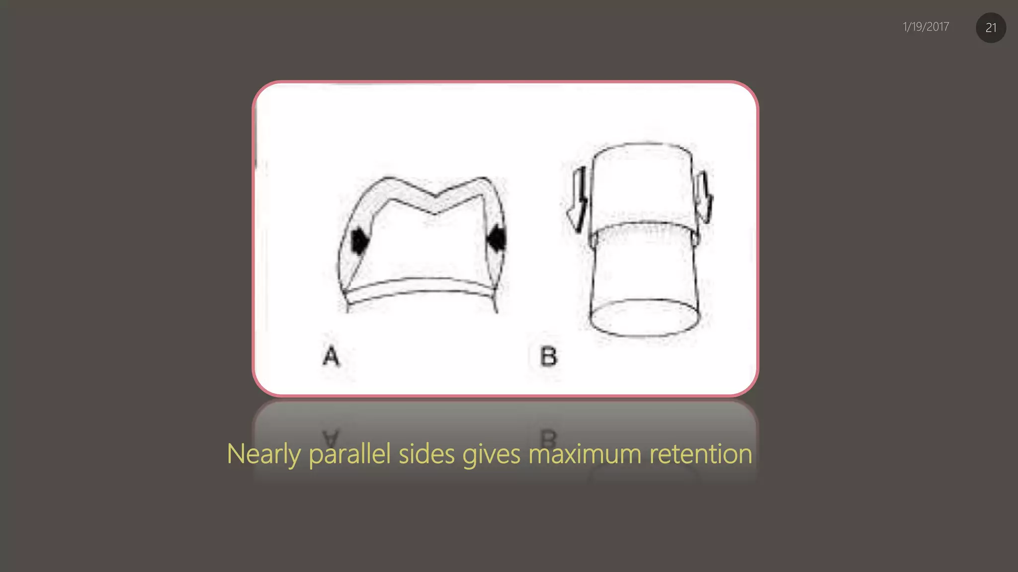 Nearly parallel sides gives maximum retention
21
 