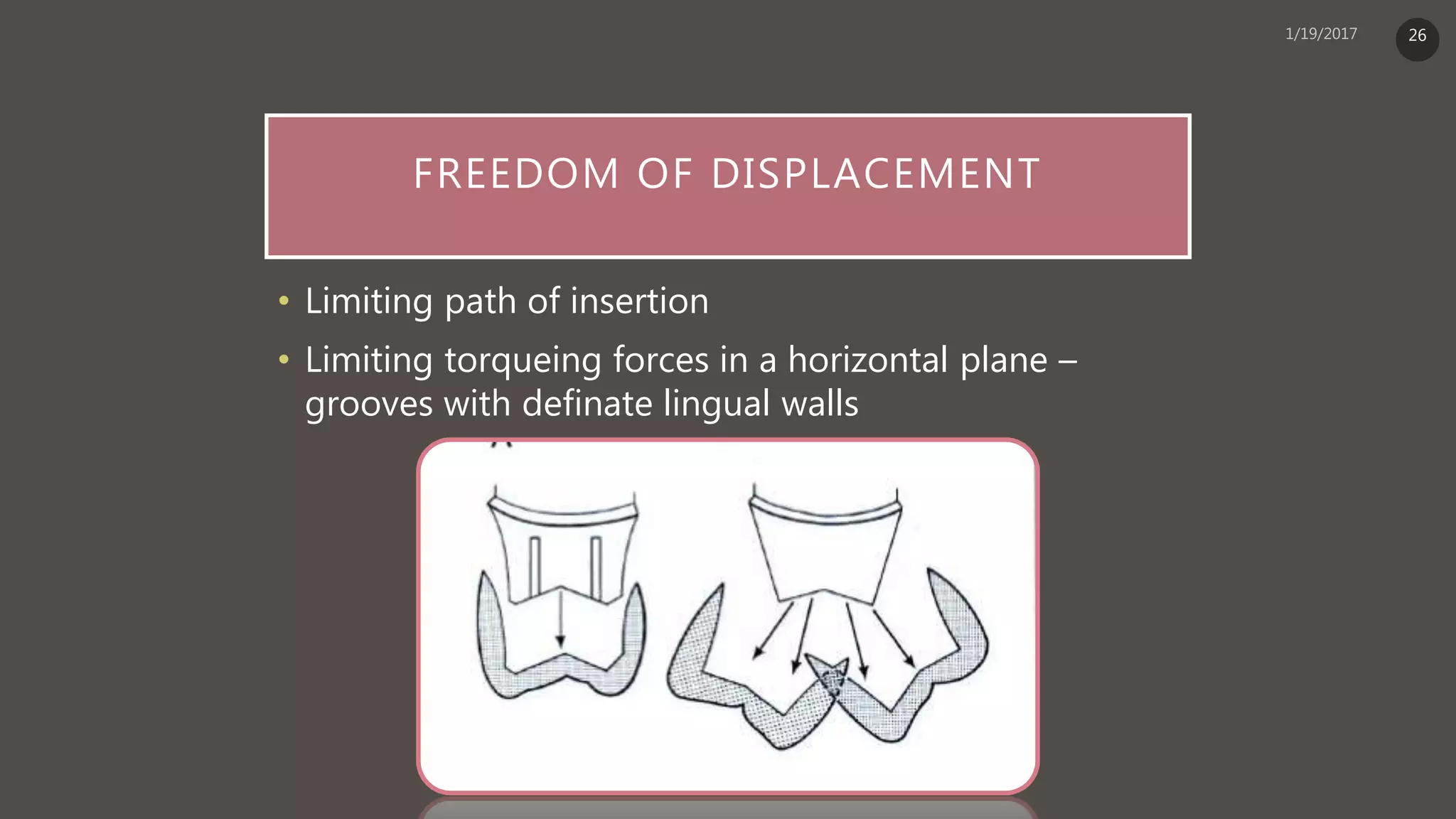 FREEDOM OF DISPLACEMENT
• Limiting path of insertion
• Limiting torqueing forces in a horizontal plane –
grooves with definate lingual walls
26
 