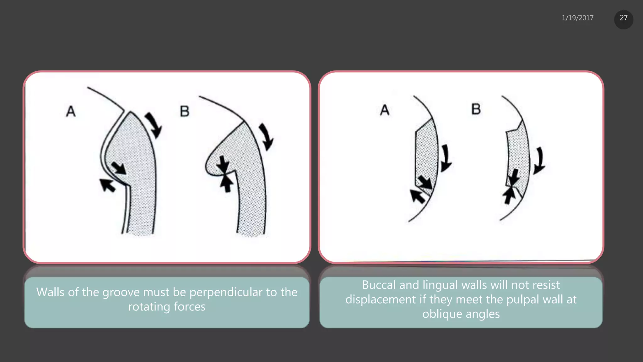 Walls of the groove must be perpendicular to the
rotating forces
Buccal and lingual walls will not resist
displacement if they meet the pulpal wall at
oblique angles
27
 