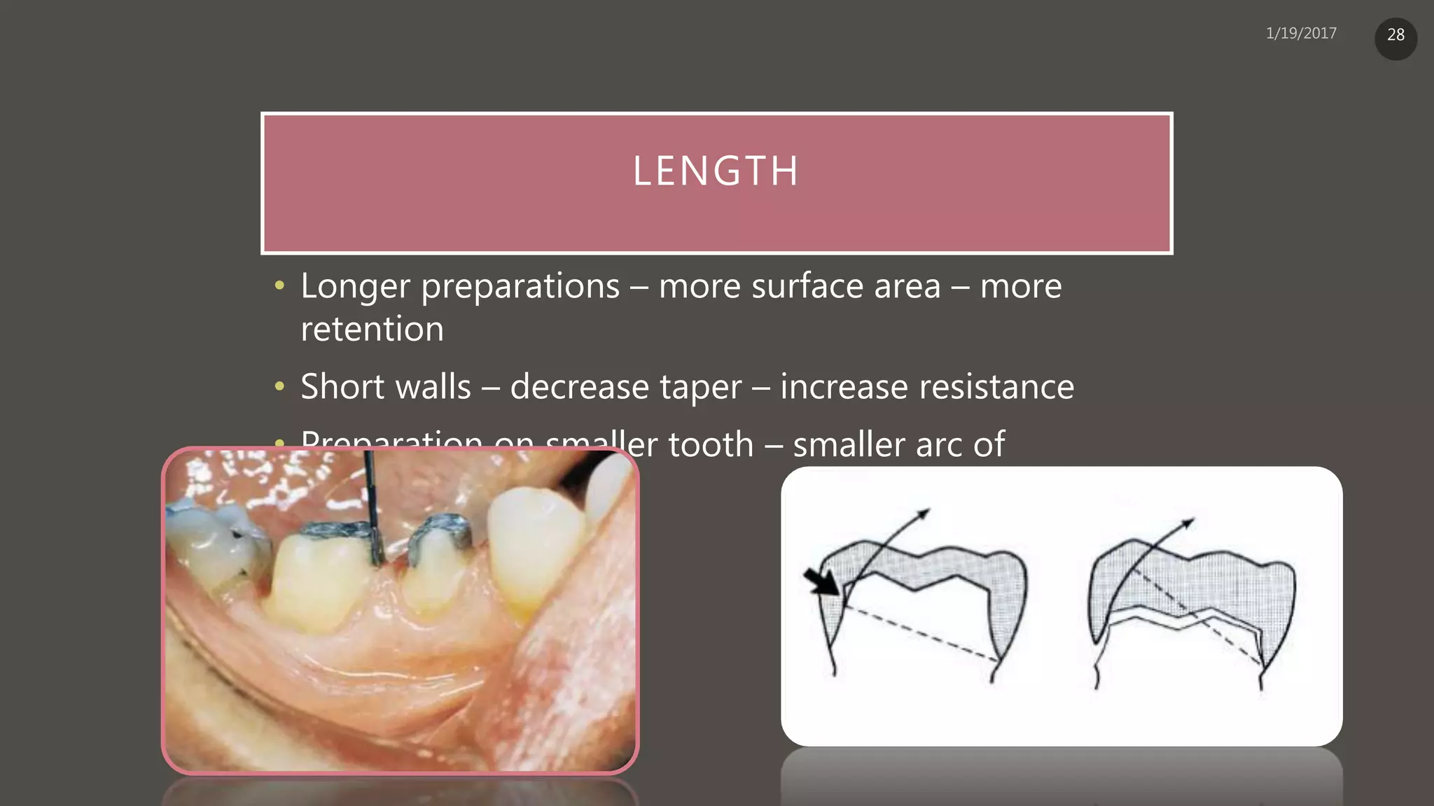 LENGTH
• Longer preparations – more surface area – more
retention
• Short walls – decrease taper – increase resistance
• Preparation on smaller tooth – smaller arc of
displacement
28
 
