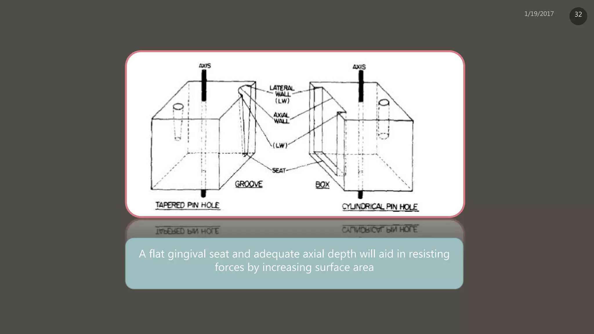 A flat gingival seat and adequate axial depth will aid in resisting
forces by increasing surface area
32
 