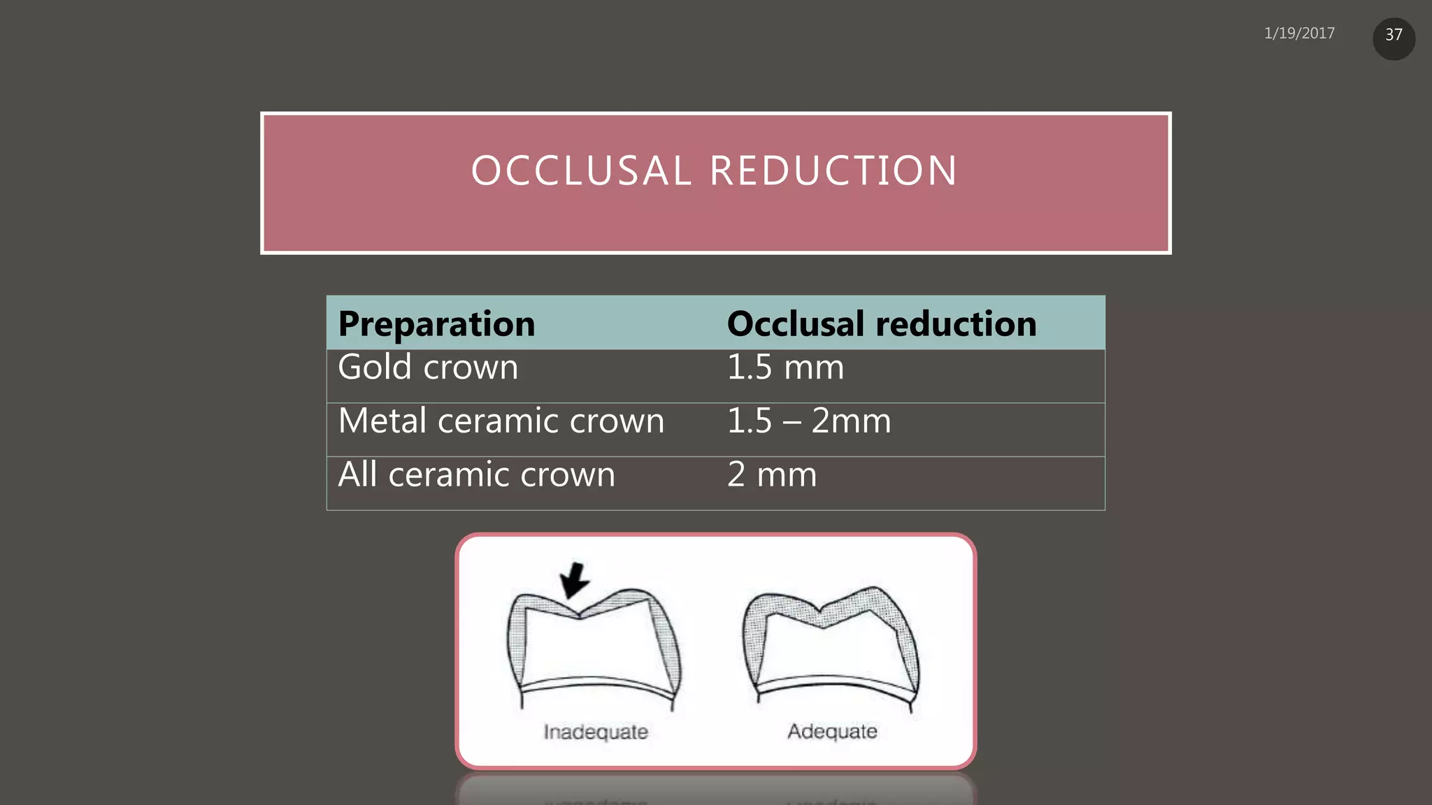 OCCLUSAL REDUCTION
Preparation Occlusal reduction
Gold crown 1.5 mm
Metal ceramic crown 1.5 – 2mm
All ceramic crown 2 mm
37
 