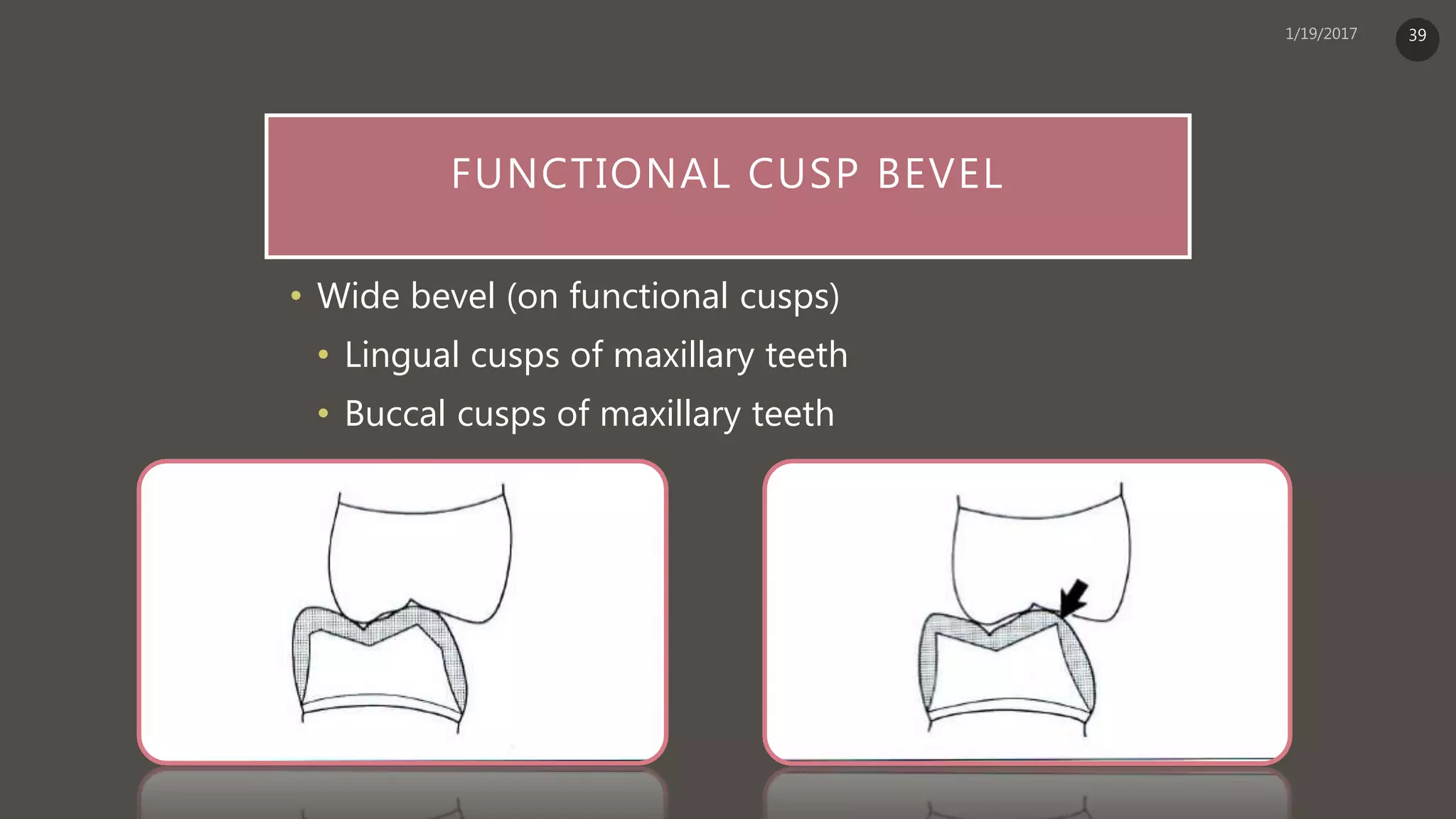 FUNCTIONAL CUSP BEVEL
• Wide bevel (on functional cusps)
• Lingual cusps of maxillary teeth
• Buccal cusps of maxillary teeth
39
 