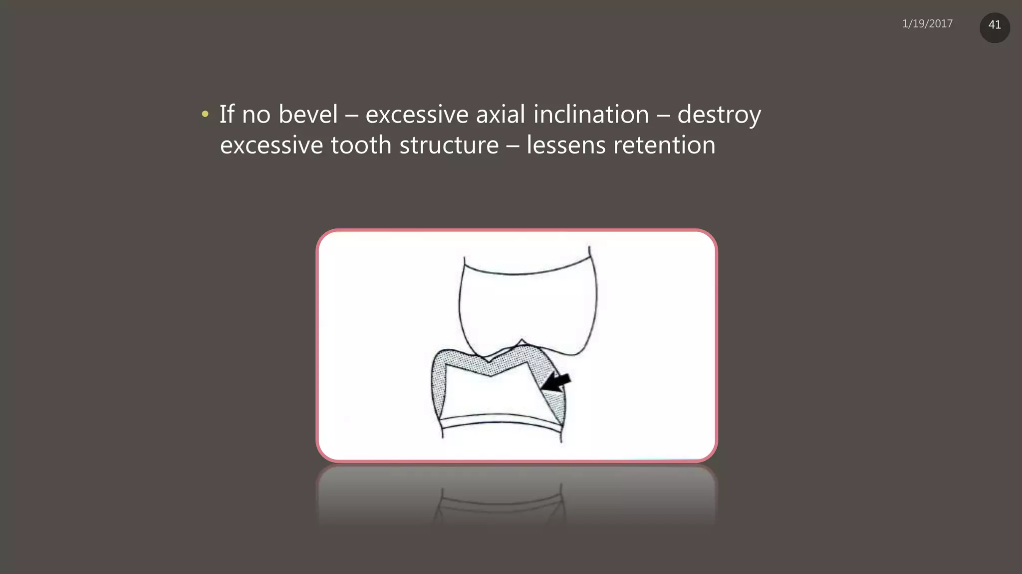 • If no bevel – excessive axial inclination – destroy
excessive tooth structure – lessens retention
41
 