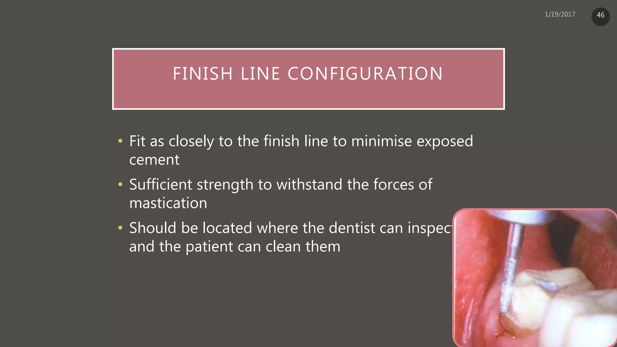 FINISH LINE CONFIGURATION
• Fit as closely to the finish line to minimise exposed
cement
• Sufficient strength to withstand the forces of
mastication
• Should be located where the dentist can inspect them
and the patient can clean them
46
 