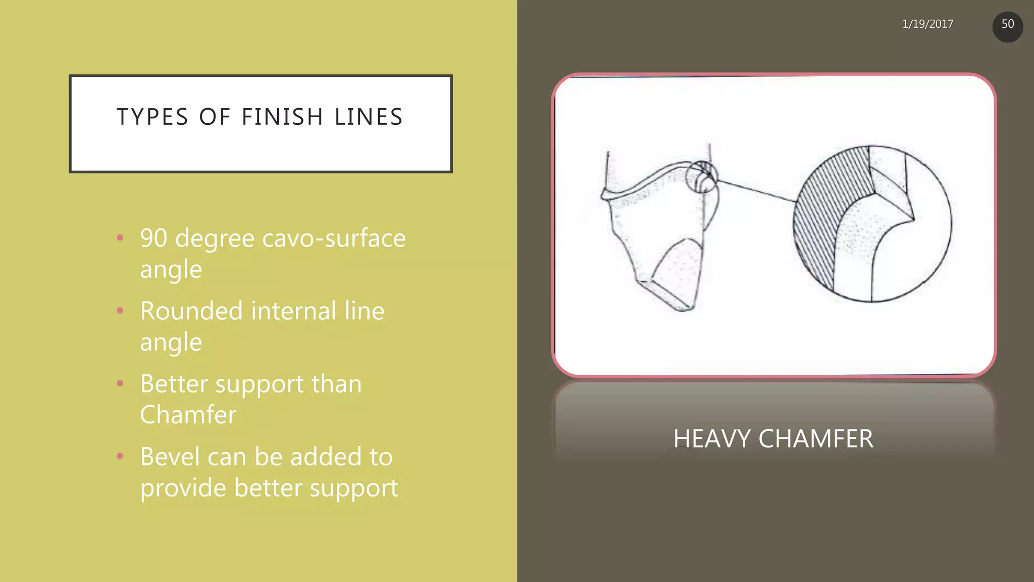 TYPES OF FINISH LINES
• 90 degree cavo-surface
angle
• Rounded internal line
angle
• Better support than
Chamfer
• Bevel can be added to
provide better support
HEAVY CHAMFER
1/19/2017 50
 