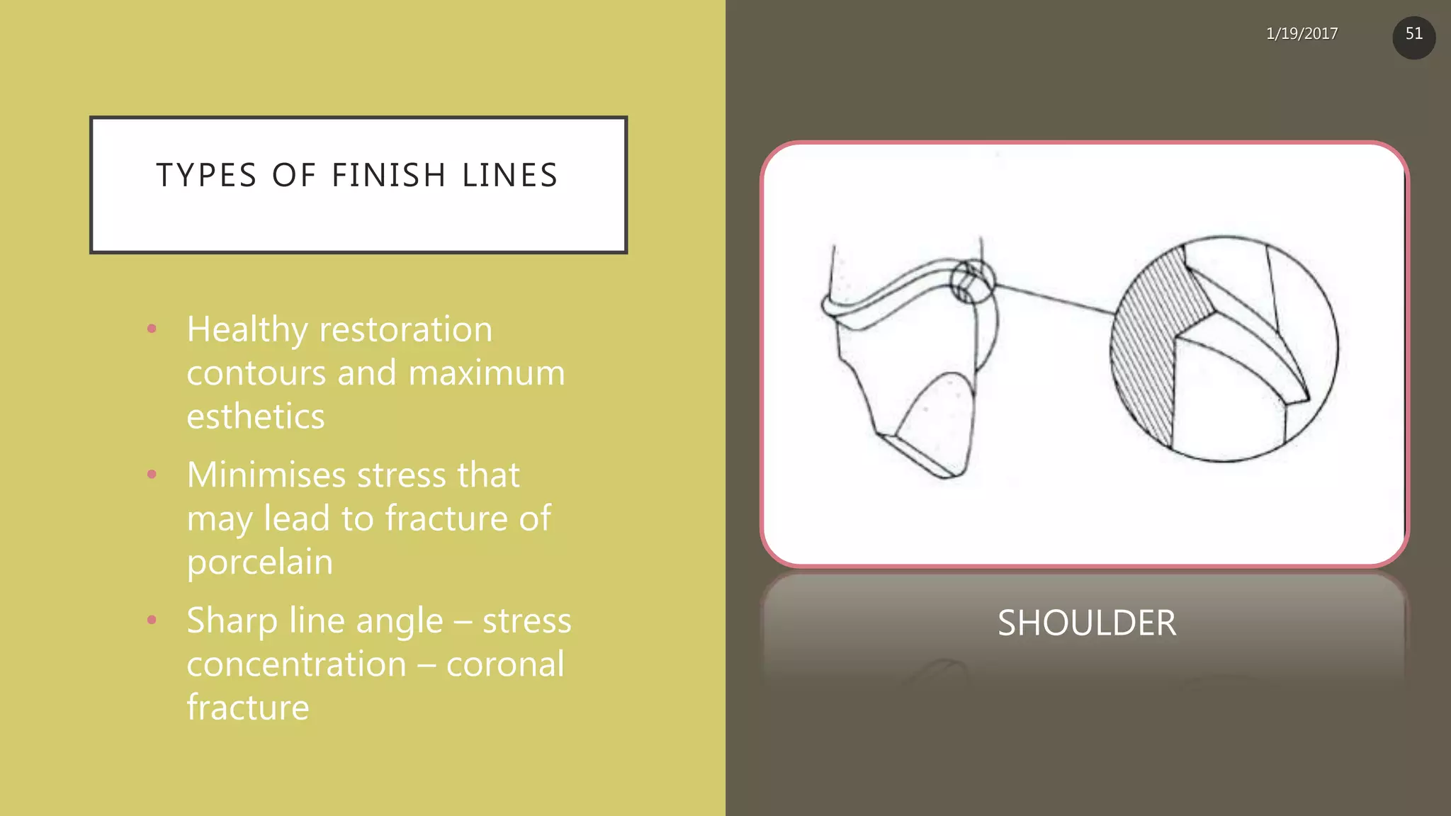 TYPES OF FINISH LINES
• Healthy restoration
contours and maximum
esthetics
• Minimises stress that
may lead to fracture of
porcelain
• Sharp line angle – stress
concentration – coronal
fracture
SHOULDER
1/19/2017 51
 