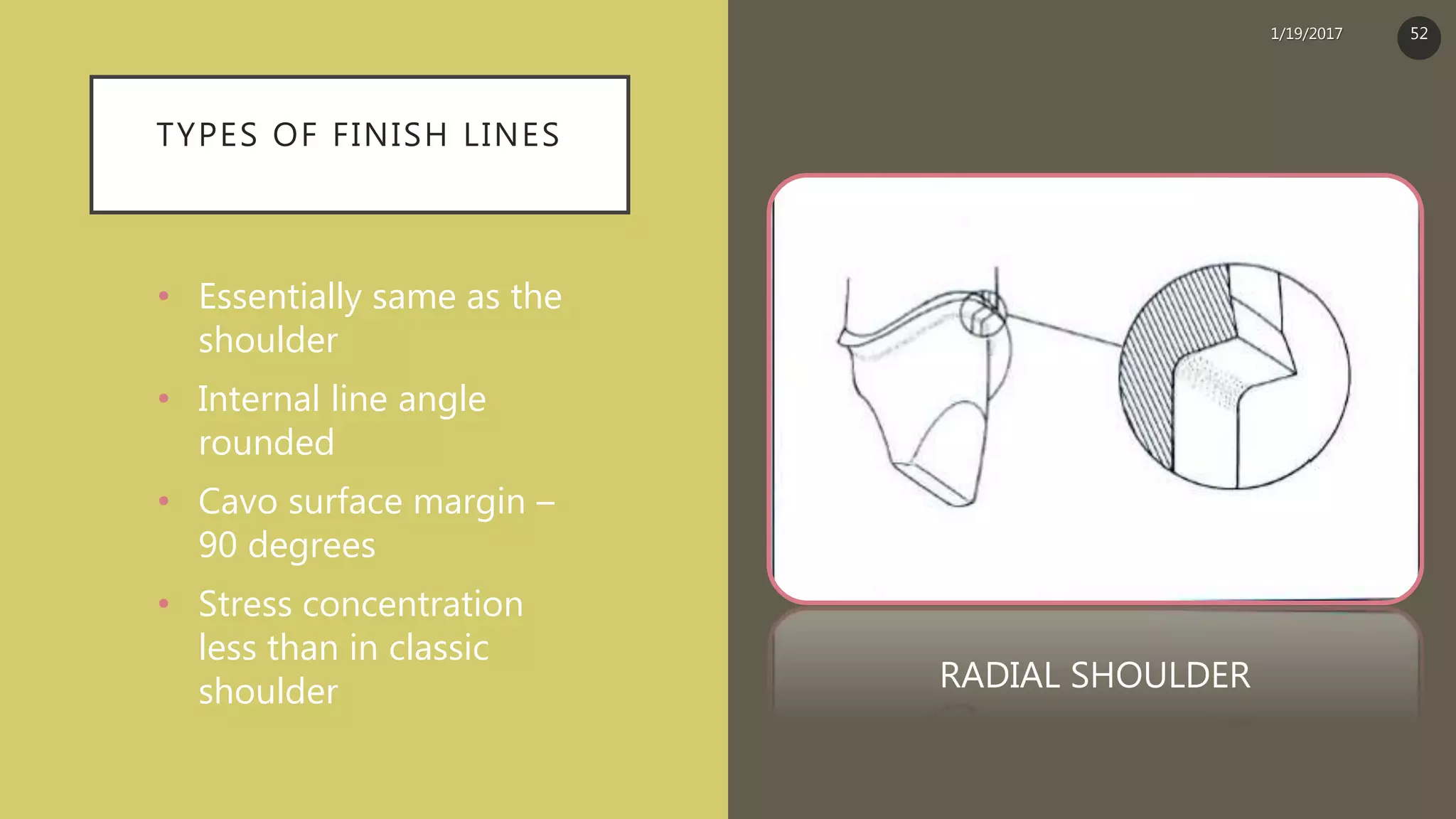 TYPES OF FINISH LINES
• Essentially same as the
shoulder
• Internal line angle
rounded
• Cavo surface margin –
90 degrees
• Stress concentration
less than in classic
shoulder RADIAL SHOULDER
1/19/2017 52
 