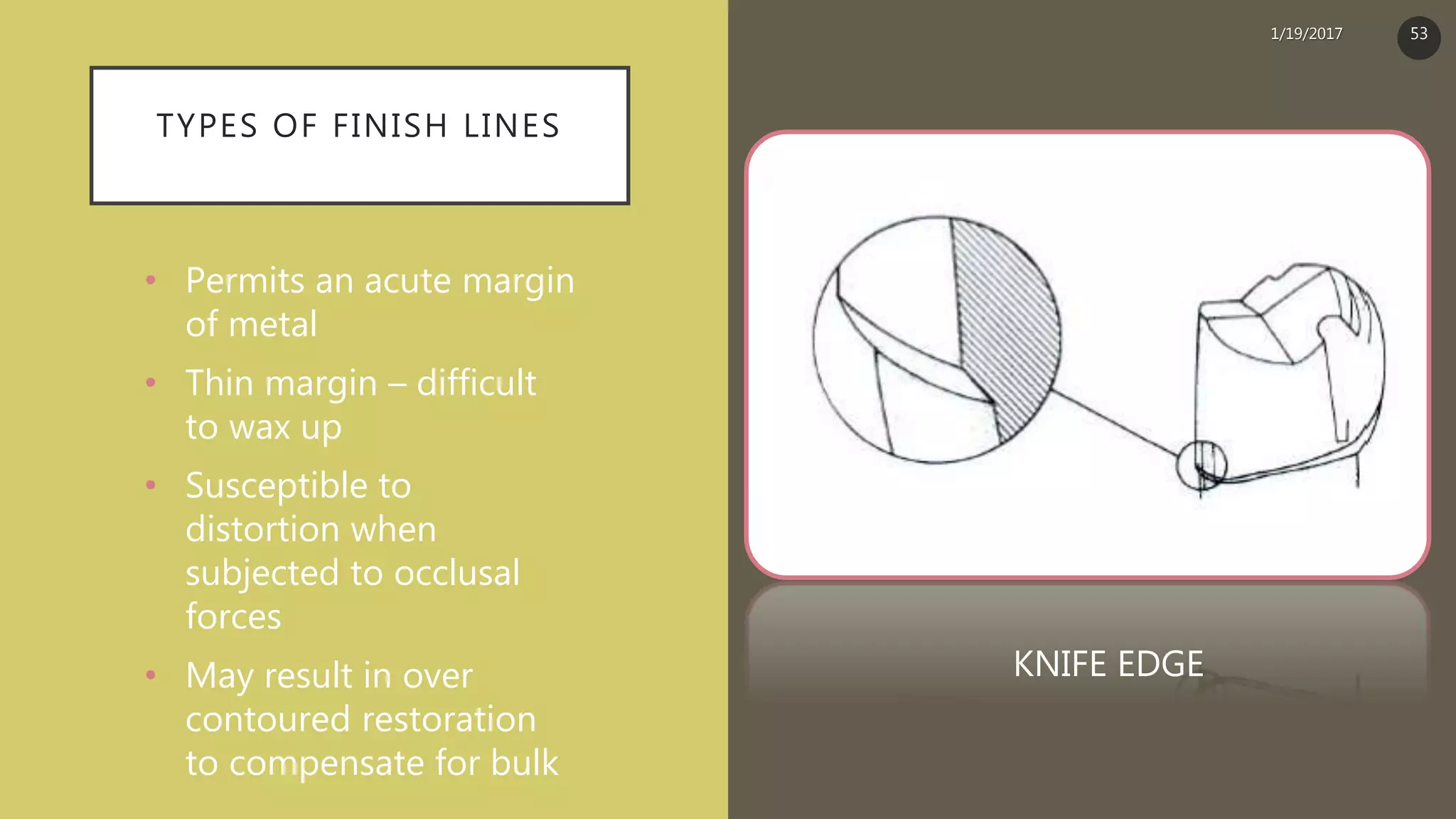 TYPES OF FINISH LINES
• Permits an acute margin
of metal
• Thin margin – difficult
to wax up
• Susceptible to
distortion when
subjected to occlusal
forces
• May result in over
contoured restoration
to compensate for bulk
KNIFE EDGE
1/19/2017 53
 