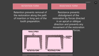 RETENTION FORM
Retention prevents removal of
the restoration along the path
of insertion or long axis of the
tooth preparation.
Resistance prevents
dislodgment of the
restoration by forces directed
in an apical or oblique
direction and prevents any
movement of the restoration
under occlusal forces.
RESISTANCE FORM
19
 