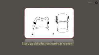 Nearly parallel sides gives maximum retention
21
 