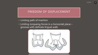 FREEDOM OF DISPLACEMENT
• Limiting path of insertion
• Limiting torqueing forces in a horizontal plane –
grooves with definate lingual walls
26
 