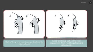 Walls of the groove must be perpendicular to the
rotating forces
Buccal and lingual walls will not resist
displacement if they meet the pulpal wall at
oblique angles
27
 