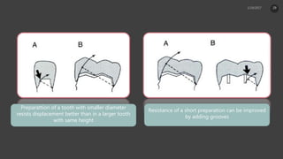 Preparattion of a tooth with smaller diameter
resists displacement better than in a larger tooth
with same height
Resistance of a short preparation can be improved
by adding grooves
29
 