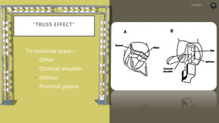 “TRUSS EFFECT”
To maximise space –
• Offset
• Occlusal shoulder
• Isthmus
• Proximal groove
1/19/2017 44
 
