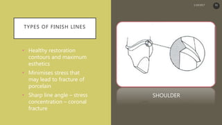 TYPES OF FINISH LINES
• Healthy restoration
contours and maximum
esthetics
• Minimises stress that
may lead to fracture of
porcelain
• Sharp line angle – stress
concentration – coronal
fracture
SHOULDER
1/19/2017 51
 