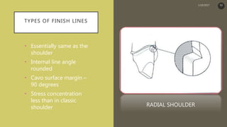 TYPES OF FINISH LINES
• Essentially same as the
shoulder
• Internal line angle
rounded
• Cavo surface margin –
90 degrees
• Stress concentration
less than in classic
shoulder RADIAL SHOULDER
1/19/2017 52
 