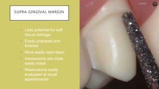 SUPRA GINGIVAL MARGIN
• Less potential for soft
tissue damage
• Easily prepared and
finished
• More easily kept clean
• Impressions are more
easily made
• Restorations easily
evaluated at recall
appointments
1/19/2017 59
 