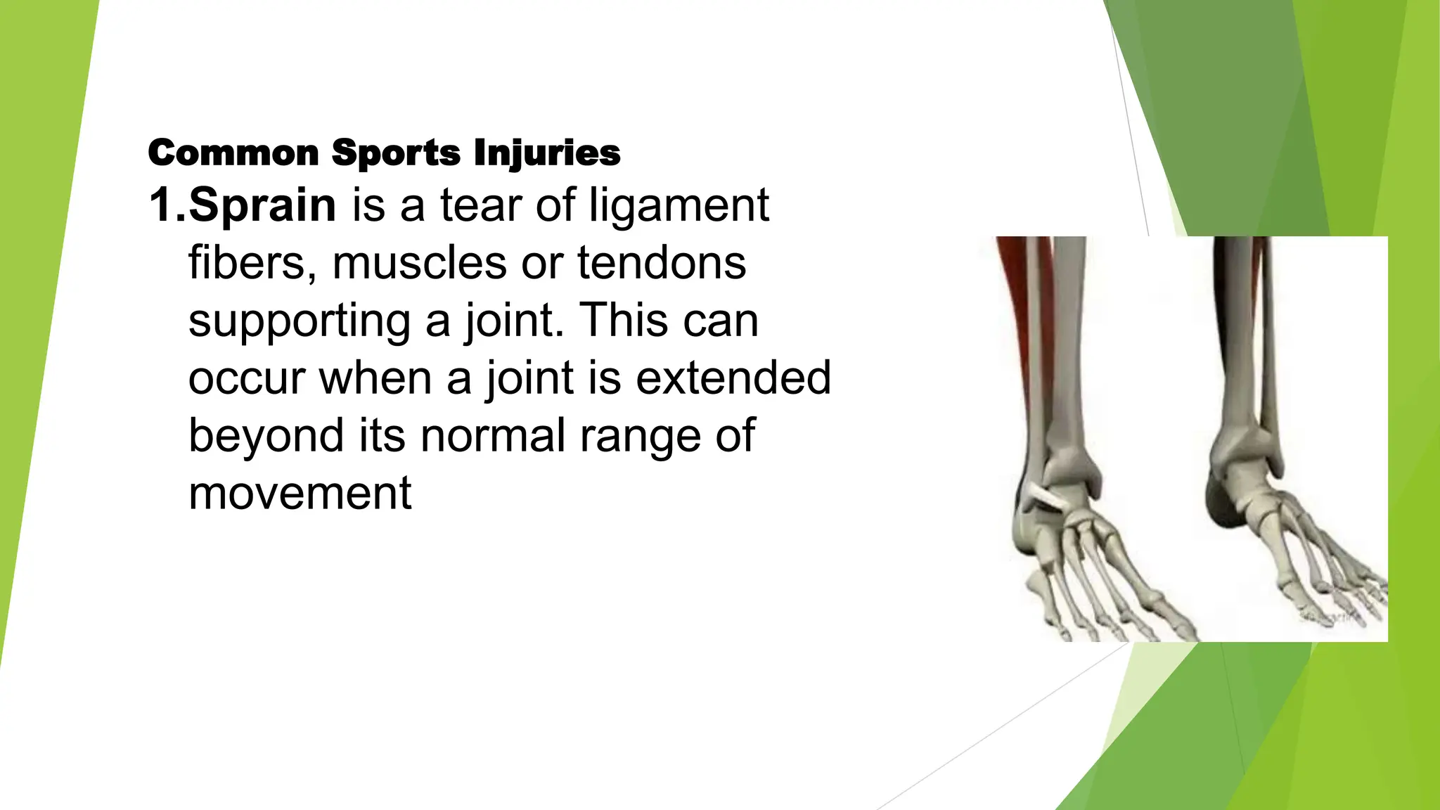 principle of training and sports injuries.pptx
