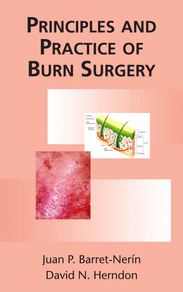 Principles.and.practice.of.burn.surgery.3 haxap