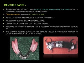 Principles of designing in Removable Partial dentures | PPTX
