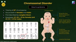 © 2022, Aakash BYJU'S. All rights reserved
Chromosomal Disorder
Down’s syndrome
 Trisomy of 21st chromosome
 Occurs both in females and males
 First described by Langdon Down
 Karyotype: 47, XX, + 21 for females and
47, XY, + 21 for males
9 10 11 12 13 14 15 16
1 2 3 4 5 6 7 8
17 18 19 20 21 22 XX XY
or
Growth failure
Short- broad hands,
palm crease, special
skin ridge patterns
Broad flat face,
slanting eyes and
short nose
Small and
arched palate, big
wrinkled tongue,
dental anomalies
Intestinal blockage
 