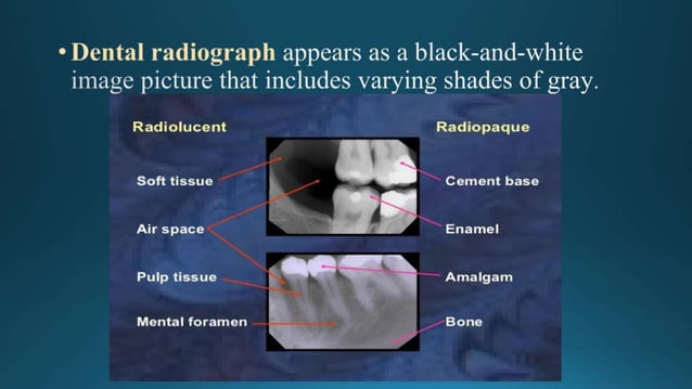 Teeth Radiopeda Principles-of-Radiographic dental radio.doc