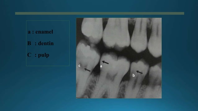 Teeth Radiopeda Principles-of-Radiographic dental radio.doc