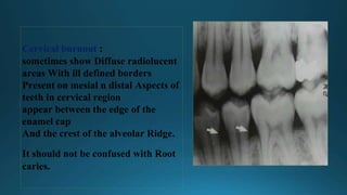 Diffuse Borders Principles-of-Radiographic dental radio.doc