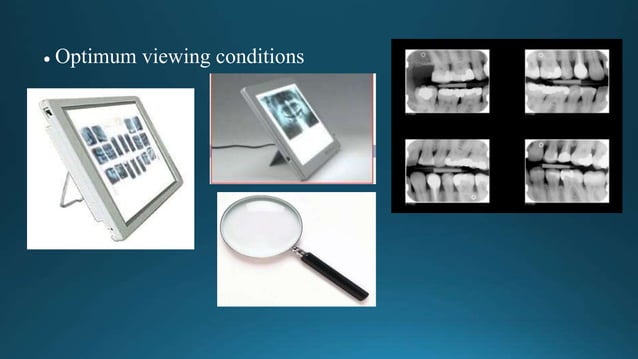 Principles-of-Radiographic dental radio.doc