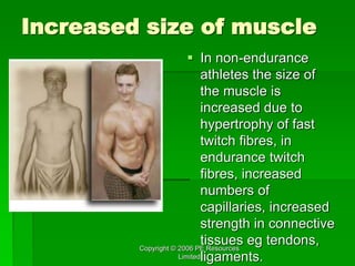 Copyright © 2006 PE Resources
Limited
Increased size of muscle
 In non-endurance
athletes the size of
the muscle is
increased due to
hypertrophy of fast
twitch fibres, in
endurance twitch
fibres, increased
numbers of
capillaries, increased
strength in connective
tissues eg tendons,
ligaments.
 