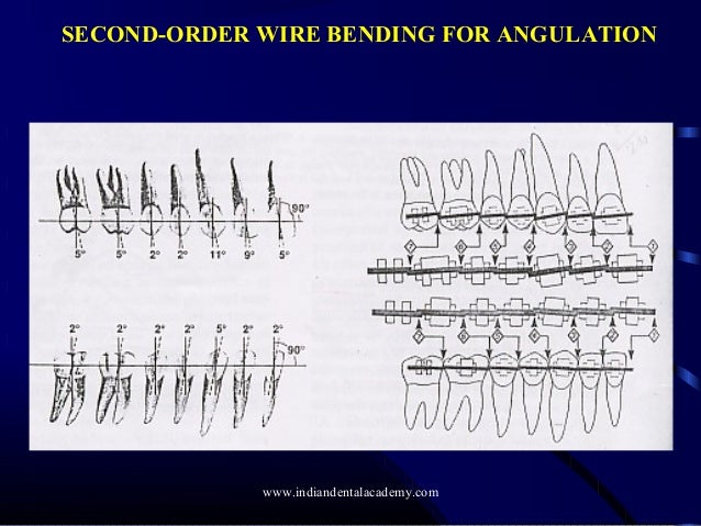 principles and concept of andrews preadjusted edgewise appliance ce edgewise appliance