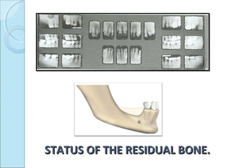 STATUS OF THE RESIDUAL BONE.
 