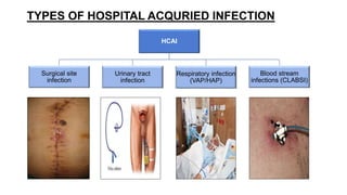 Principles and practices in hospital infection control | PPTX