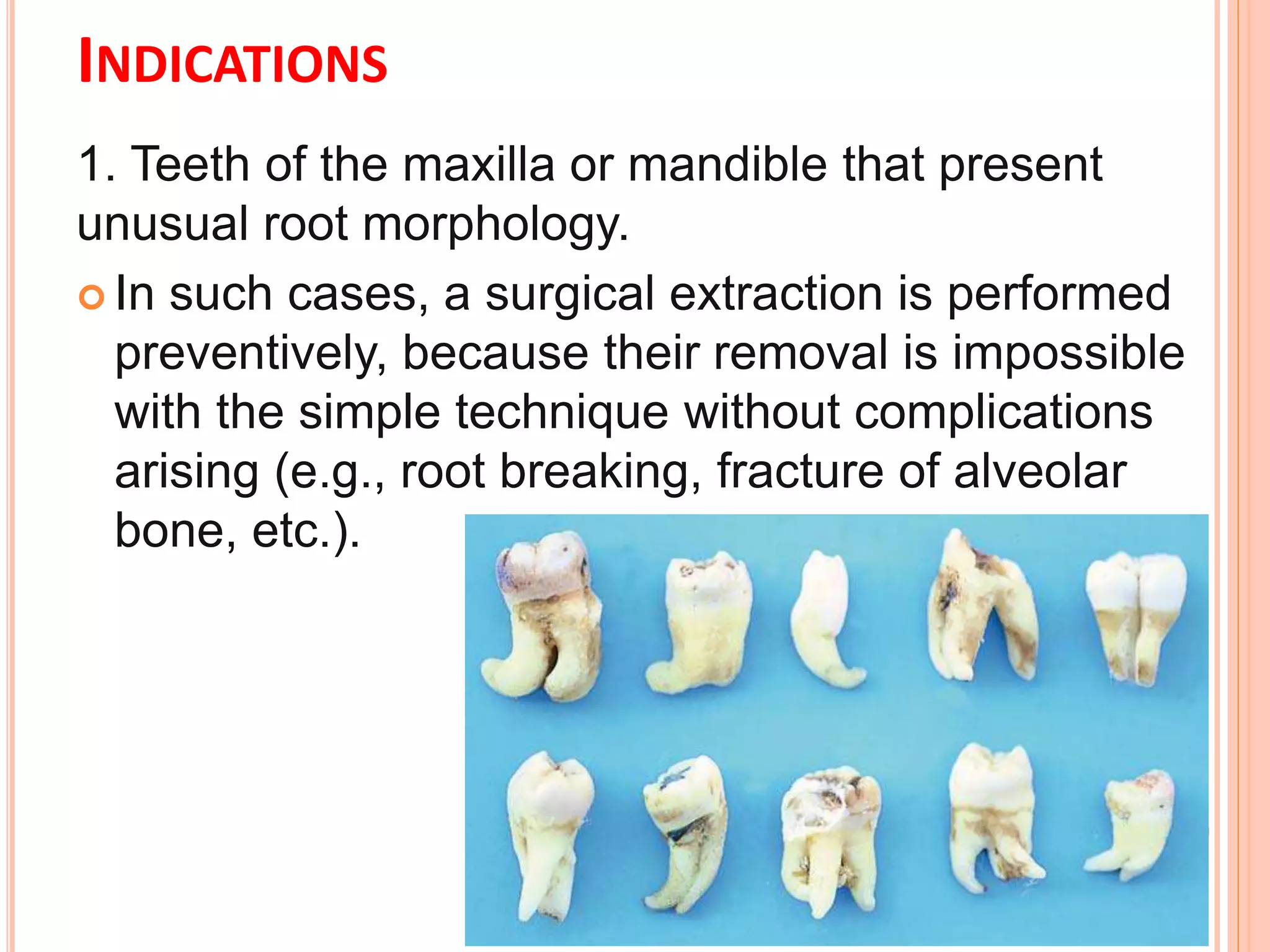 INDICATIONS
1. Teeth of the maxilla or mandible that present
unusual root morphology.
 In such cases, a surgical extraction is performed
preventively, because their removal is impossible
with the simple technique without complications
arising (e.g., root breaking, fracture of alveolar
bone, etc.).
 