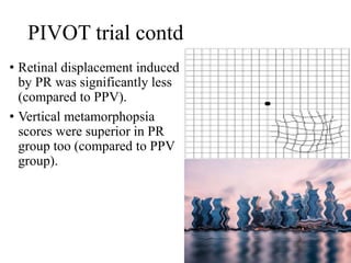 Ppv Optometry Principles and technique of pneumatic retinopexy (Dr. Avuru C.J).pptx