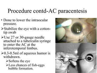 Principles and technique of pneumatic retinopexy (Dr. Avuru C.J).pptx