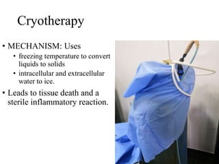 Cryotherapy
• MECHANISM: Uses
• freezing temperature to convert
liquids to solids
• intracellular and extracellular
water to ice.
• Leads to tissue death and a
sterile inflammatory reaction.
 