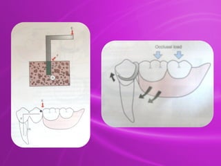 Principles & Designing of Removable partial denture.pptx