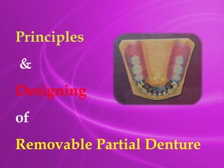 Principles & Designing of Removable partial denture.pptx