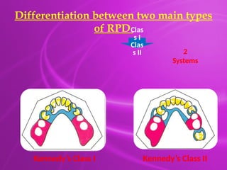 Principles & Designing of Removable partial denture.pptx