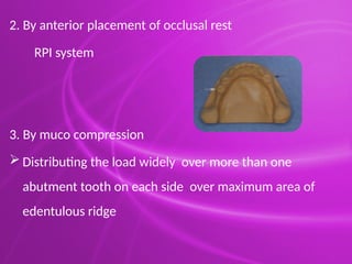 Rpcvs Rpi Dentures Principles & Designing of Removable partial denture.pptx