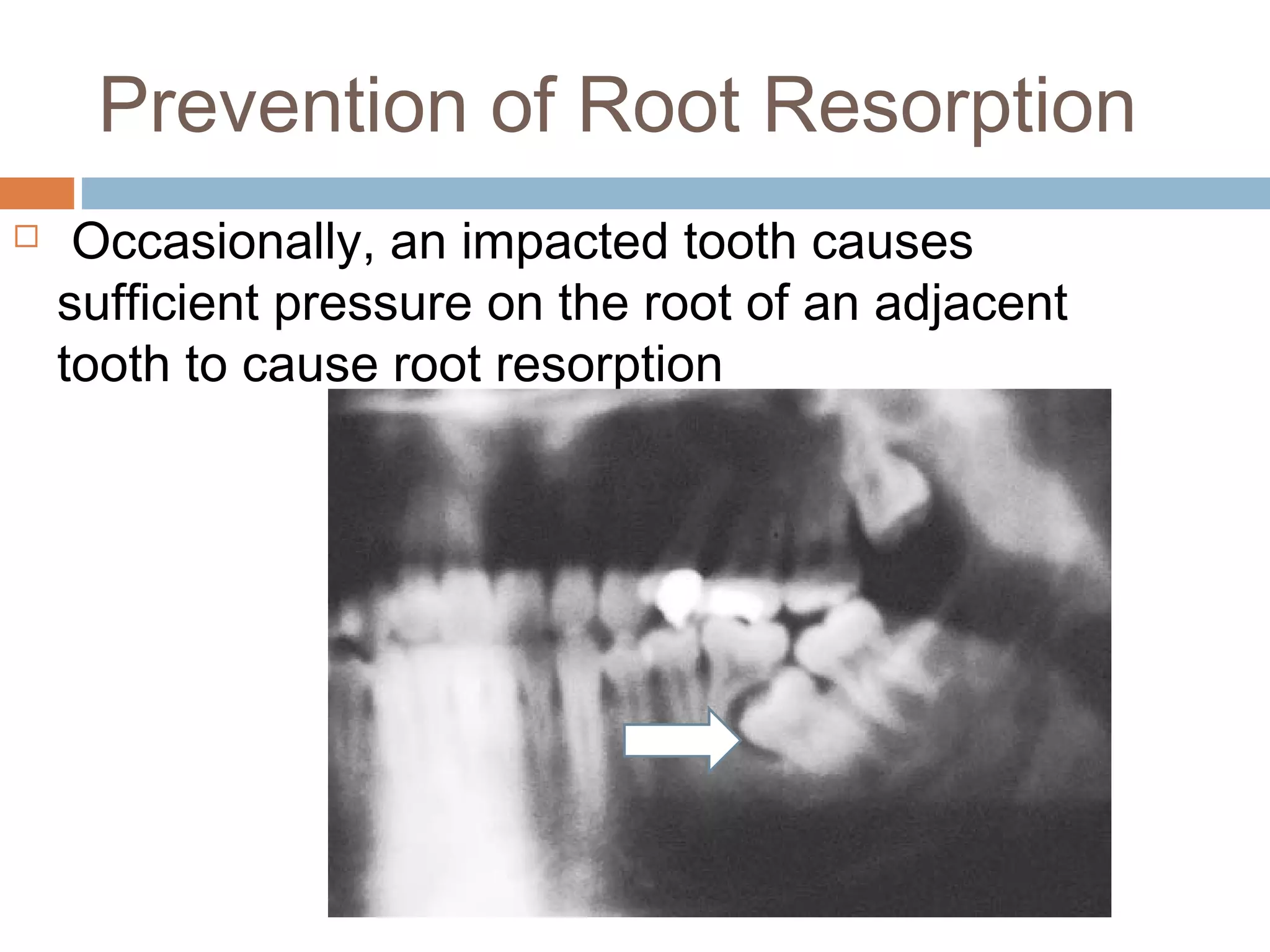 Principles, indications and contraindications of removal of | PPT