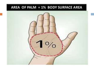 Principles in management of burns | PPTX