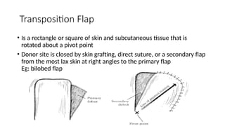 Interposition Flap Principles In Plastic Surgery including skin grafting , flaps , wound ...